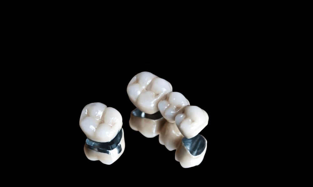 Guide to Zirconia Crown Preparation